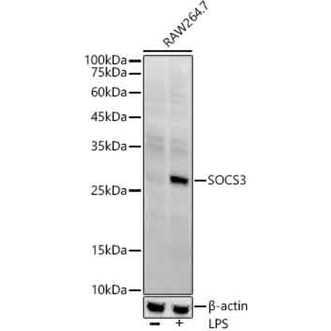 SOCS3 Rabbit Monoclonal Antibody