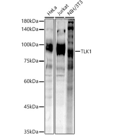 TLK1 Rabbit Polyclonal Antibody