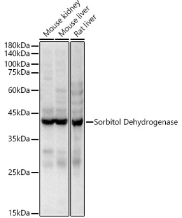 Sorbitol Dehydrogenase Rabbit Polyclonal Antibody