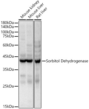 Sorbitol Dehydrogenase Rabbit Polyclonal Antibody