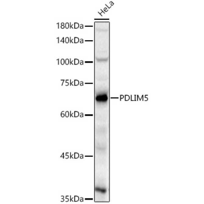 PDLIM5 Rabbit Polyclonal Antibody