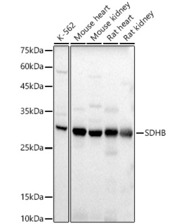 SDHB Rabbit Polyclonal Antibody