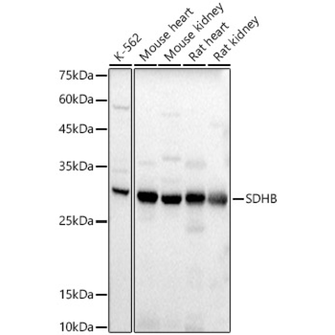 SDHB Rabbit Polyclonal Antibody