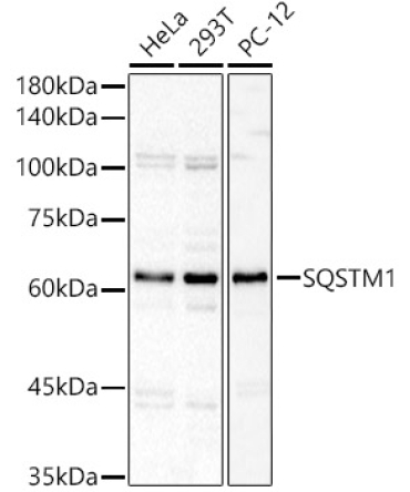 SQSTM1 Rabbit Polyclonal Antibody