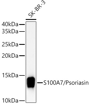 S100A7/Psoriasin Rabbit Polyclonal Antibody