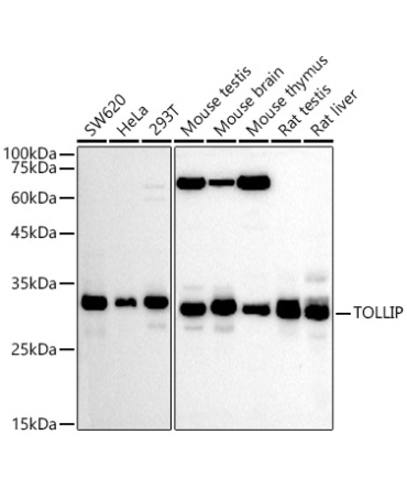 TOLLIP Rabbit Polyclonal Antibody
