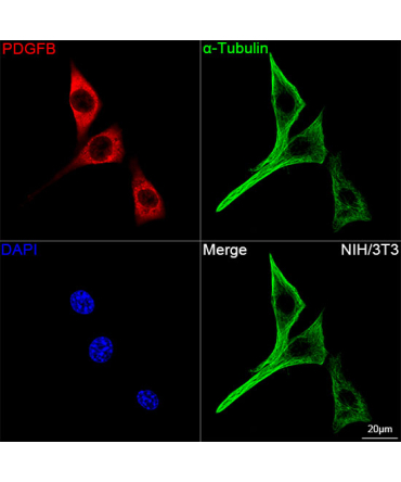 PDGFB Rabbit Monoclonal Antibody