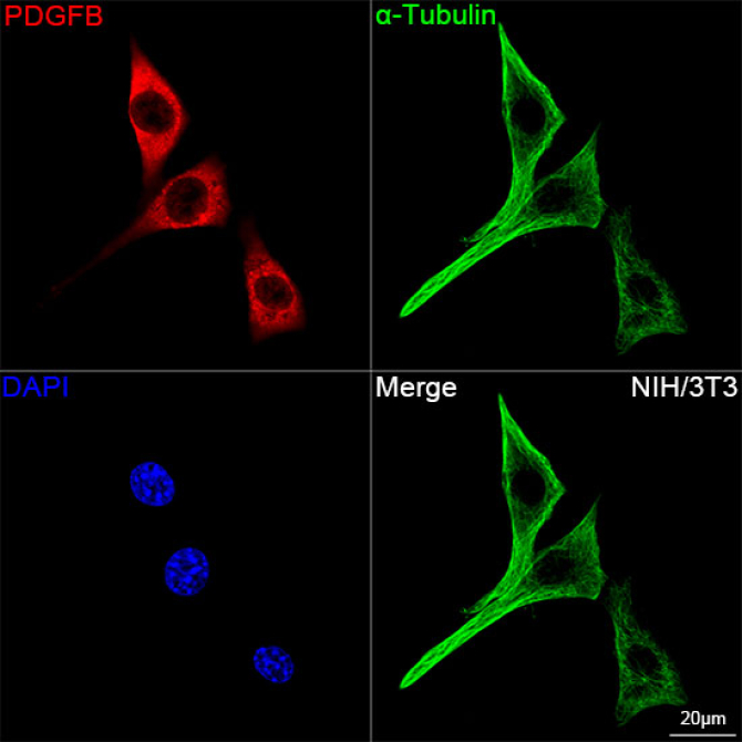 PDGFB Rabbit Monoclonal Antibody