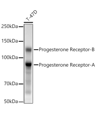 Progesterone Receptor Rabbit Monoclonal Antibody