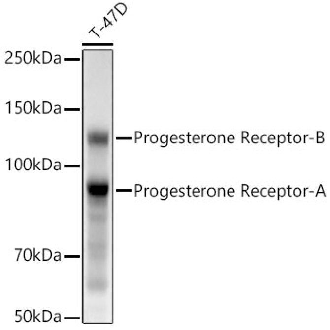 Progesterone Receptor Rabbit Monoclonal Antibody