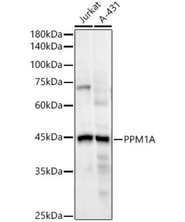 PPM1A Rabbit Monoclonal Antibody