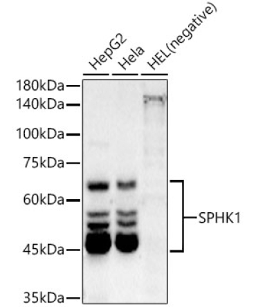SPHK1 Rabbit Monoclonal Antibody
