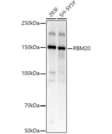 RBM20 Rabbit Polyclonal Antibody