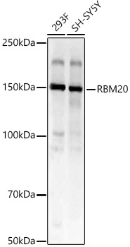 RBM20 Rabbit Polyclonal Antibody