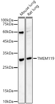 TMEM119 Rabbit Polyclonal Antibody
