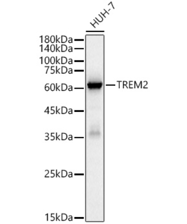 TREM2 Rabbit Monoclonal Antibody