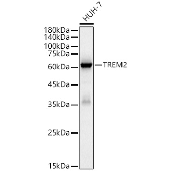 TREM2 Rabbit Monoclonal Antibody