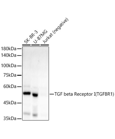 TGF beta Receptor I (TGFBR1) Rabbit Monoclonal Antibody
