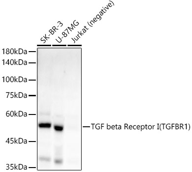 TGF beta Receptor I (TGFBR1) Rabbit Monoclonal Antibody