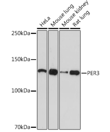 PER3 Rabbit Monoclonal Antibody