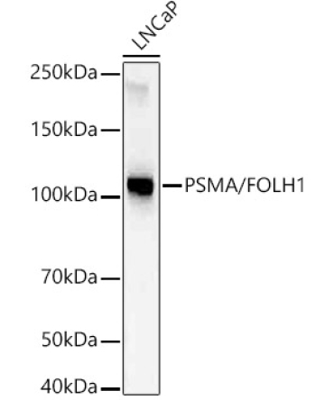 PSMA/FOLH1 Rabbit Monoclonal Antibody