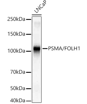 PSMA/FOLH1 Rabbit Monoclonal Antibody