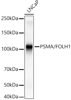 PSMA/FOLH1 Rabbit Monoclonal Antibody