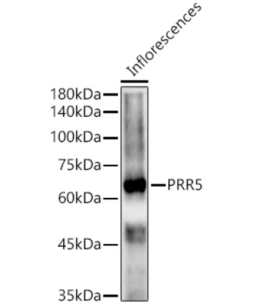PRR5 Rabbit Polyclonal Antibody