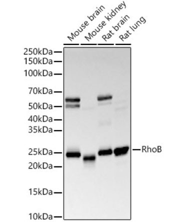 RhoB Rabbit Monoclonal Antibody
