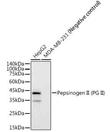 Pepsinogen II (PG II) Rabbit Monoclonal Antibody