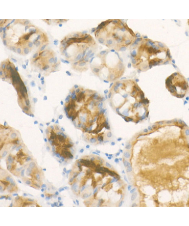 Pepsinogen II (PG II) Rabbit Monoclonal Antibody