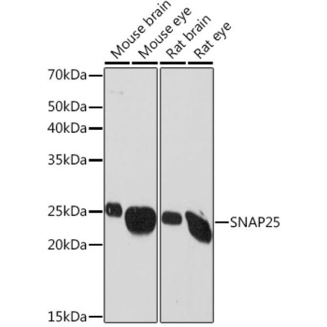 SNAP25 Rabbit Monoclonal Antibody