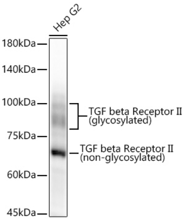 TGF beta Receptor II Rabbit Monoclonal Antibody