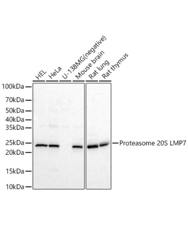 Proteasome 20S LMP7 Rabbit Polyclonal Antibody