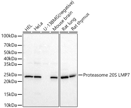 Proteasome 20S LMP7 Rabbit Polyclonal Antibody