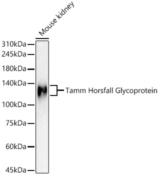 Tamm Horsfall Glycoprotein Rabbit Polyclonal Antibody