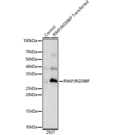 R9AP/RGS9BP Rabbit Polyclonal Antibody