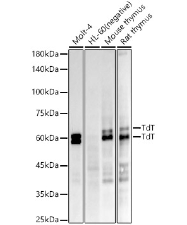TdT Rabbit Monoclonal Antibody