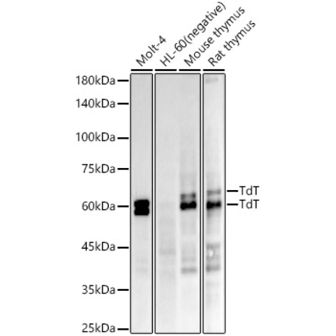 TdT Rabbit Monoclonal Antibody