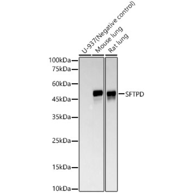 SFTPD Rabbit Monoclonal Antibody