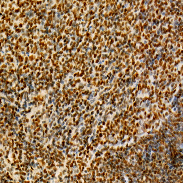 RB Rabbit Monoclonal Antibody
