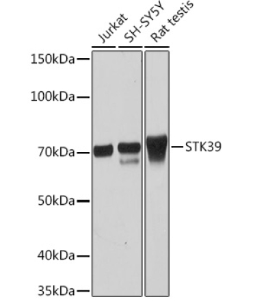 STK39 Rabbit Monoclonal Antibody