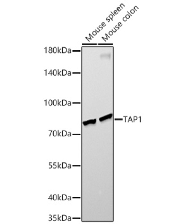 TAP1 Rabbit Monoclonal Antibody
