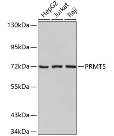PRMT5 Rabbit Polyclonal Antibody