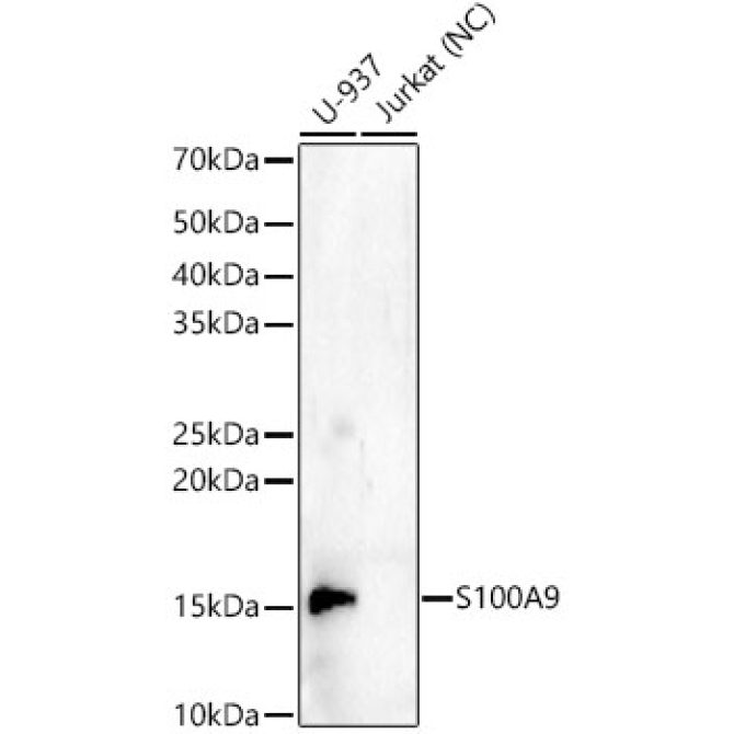 S100A9 Rabbit PolyMonoclonal Antibody?