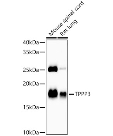 TPPP3 Rabbit Monoclonal Antibody