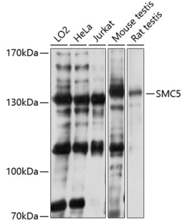 SMC5 Rabbit Polyclonal Antibody