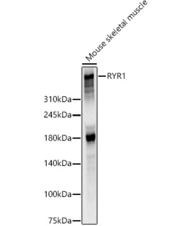 RYR1 Rabbit Polyclonal Antibody