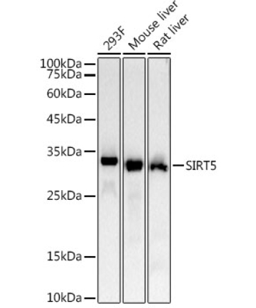 SIRT5 Rabbit Monoclonal Antibody