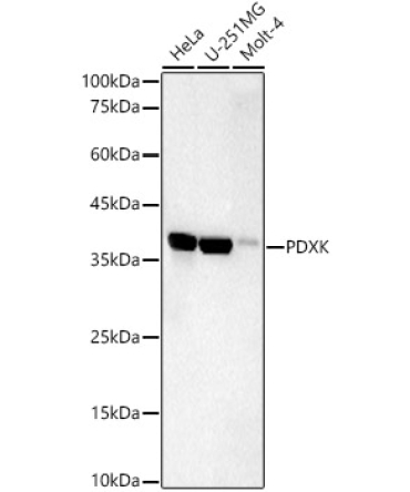 PDXK Rabbit Monoclonal Antibody